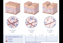 都在問(wèn)的乙酰殼糖胺（NAG）功效怎么樣？功效成分的護膚品應該怎么選？